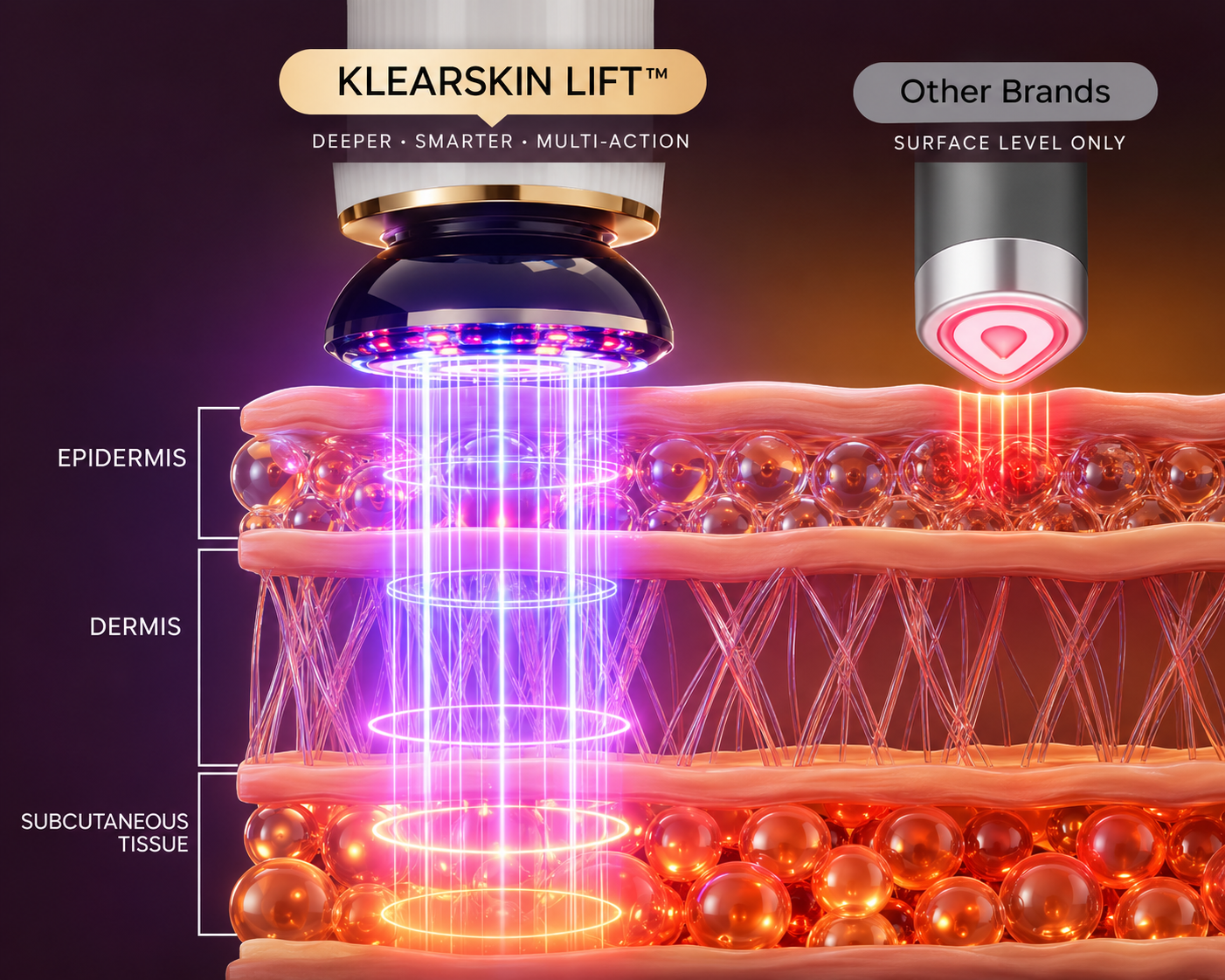 Our New KlearSkin Lift RF™